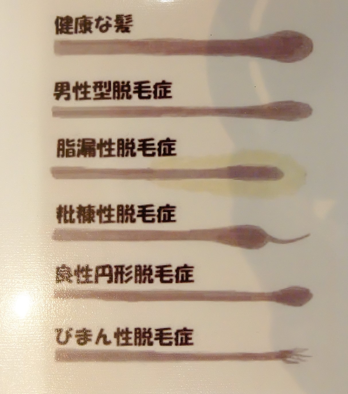 毛根抜ける: 毛を抜く 生えてこない _ 抜け毛の毛根でできる薄毛診断 – FABXL